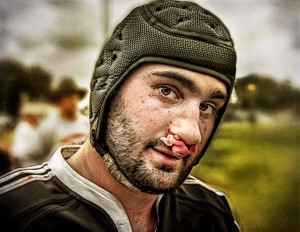 Wes poses for a picture after breaking his nose in a match for a Los Angeles area club side.